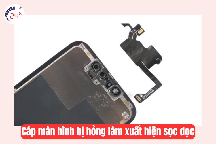 cáp màn hình bị hỏng