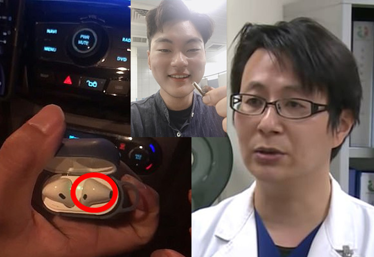 Bác sĩ Chen Chieh-fan đã nhận định lớp vỏ nhựa của AirPods đã bảo vệ Hsu